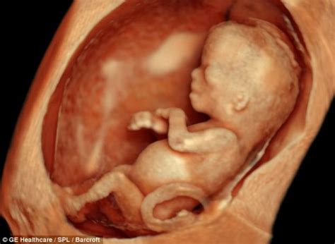 12 haftalık anne karnındaki bebek görüntüleri